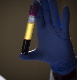 A close-up of a gloved hand holding a vial of blood at the Marcus Institute for Aging in Boston, MA